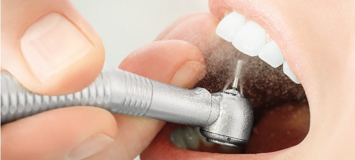 Dental disease prevention