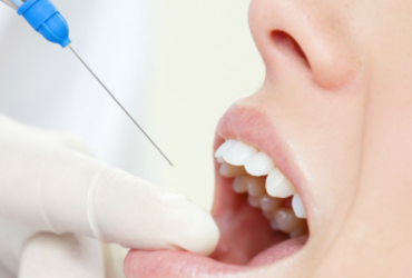 Какую анестезию используют в стоматологии?