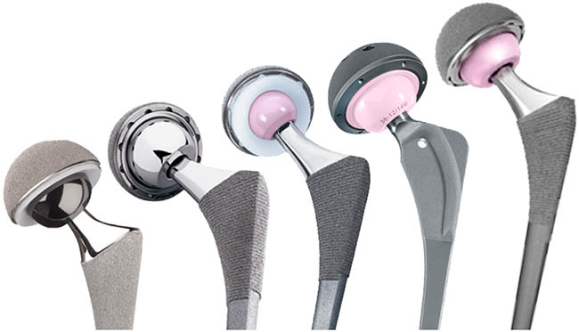 Операция по замене тазобедренного сустава в Киеве