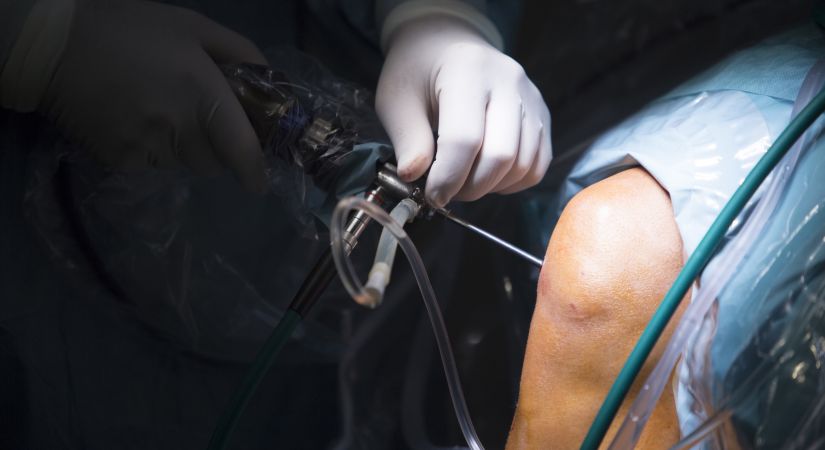 Артроскопическая менискэктомия в Киеве