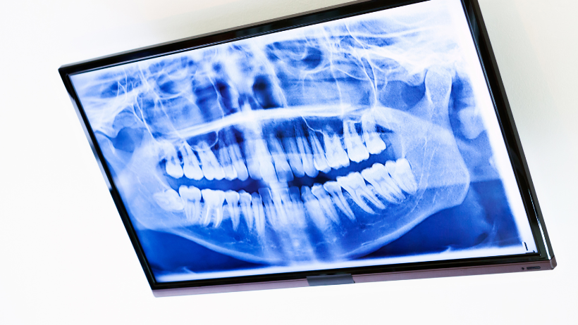 Цифровая стоматология: преимущества использования цифровых технологий 