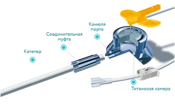 Что такое порт-система 