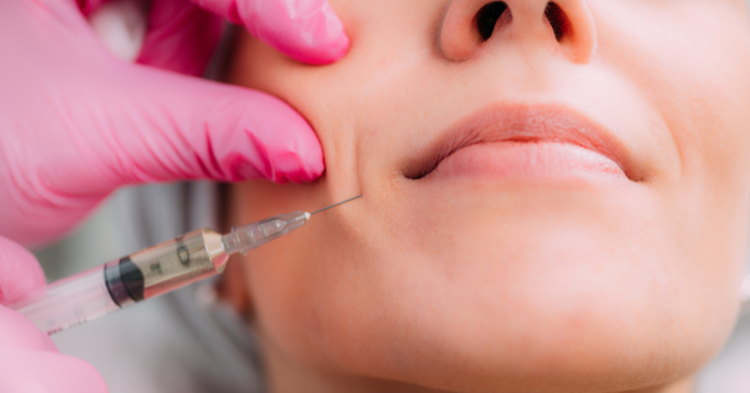 Якими ін'єкціями можна зменшити носогубні складки