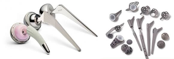 Повне ревізійное ендопротезування