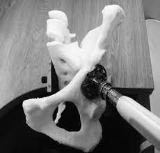 3D-моделирование операции в ортопедии в Оксфорд Медикал