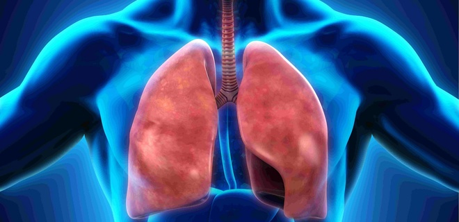  рак легень