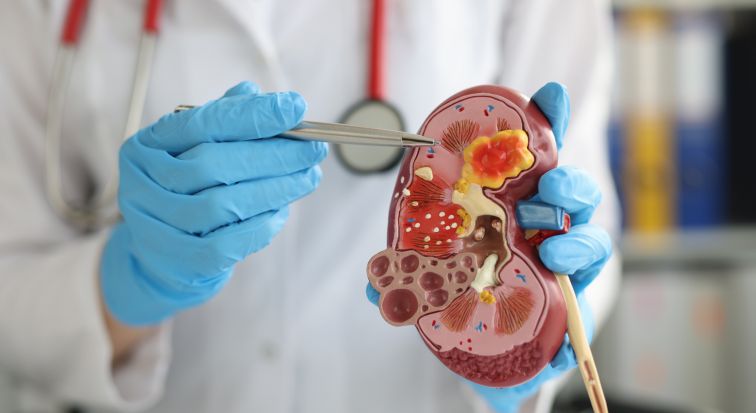 Лапароскопическая резекция почки