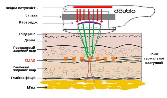 СМАС-лифтинг: восстановление молодости лица 