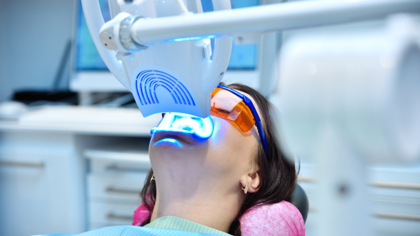 Профессиональное отбеливание зубов у стоматолога