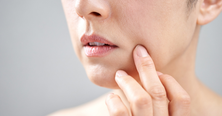 Чому з'являються носогубні складки