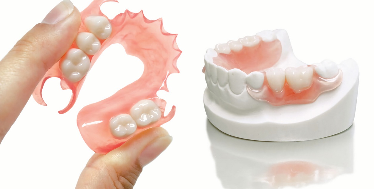 Что такое нейлоновые зубные протезы