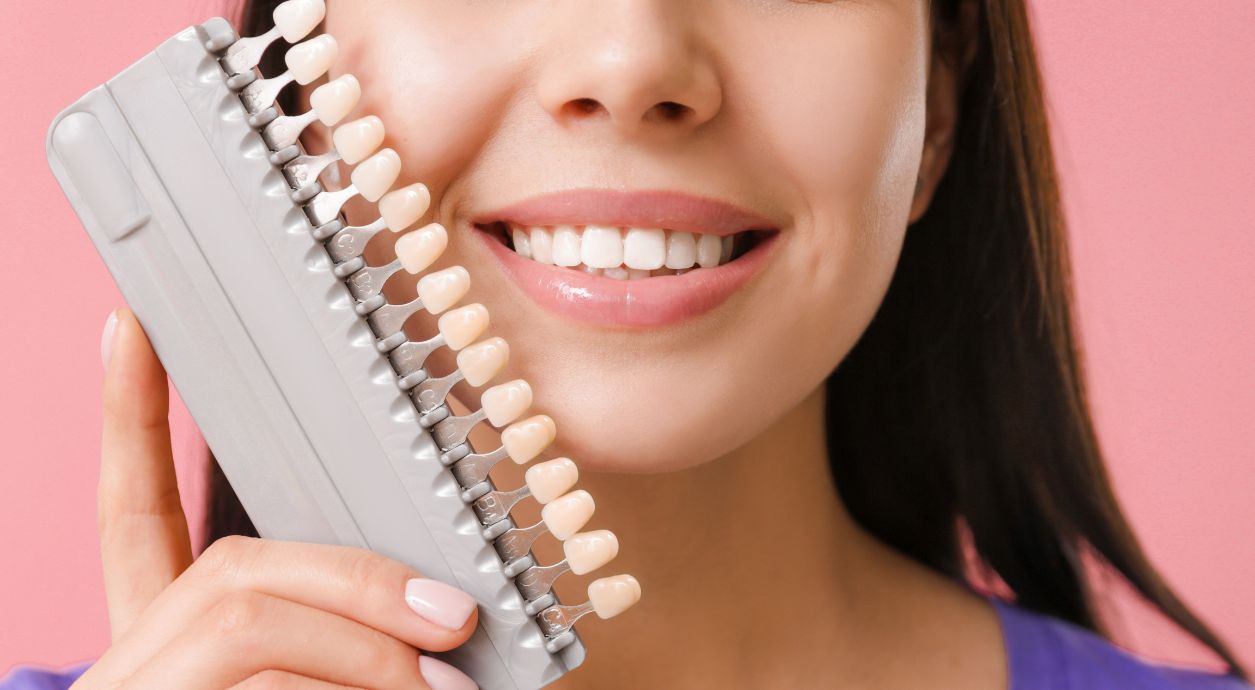 Что такое виниры: виды виниров, их плюсы и минусы