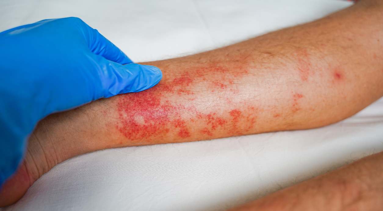 Откуда берётся боль в челюсти, если зубы здоровы