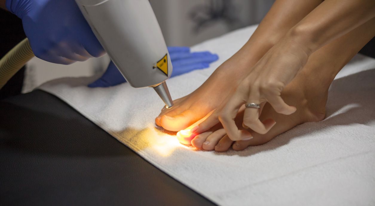 Как лечить грибок ногтей