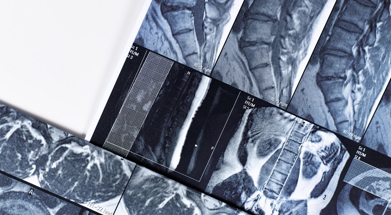 Как часто можно делать МРТ