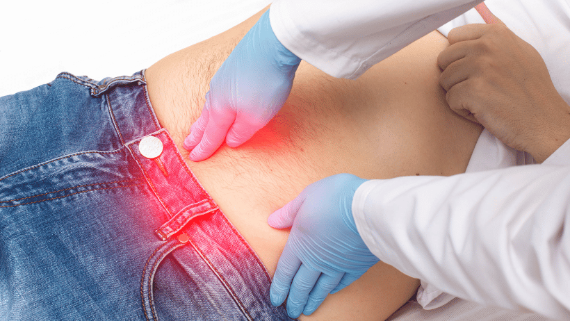 Показання до видалення пупкової грижі