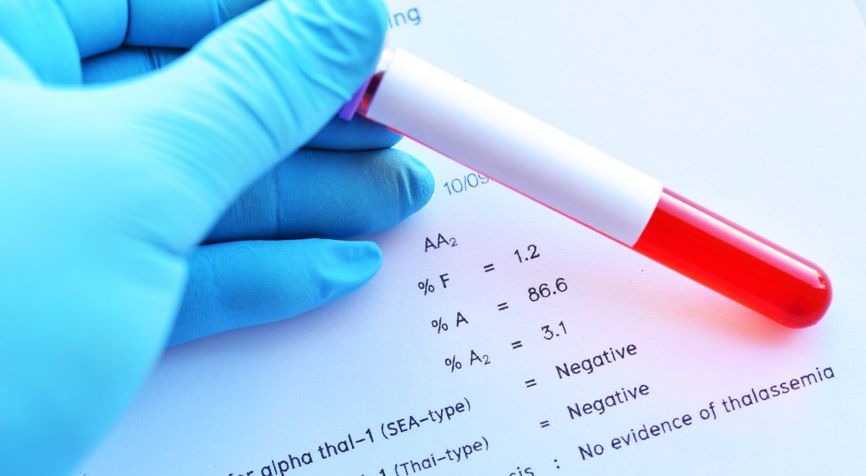 How to Understand That Hemoglobin Is Low
