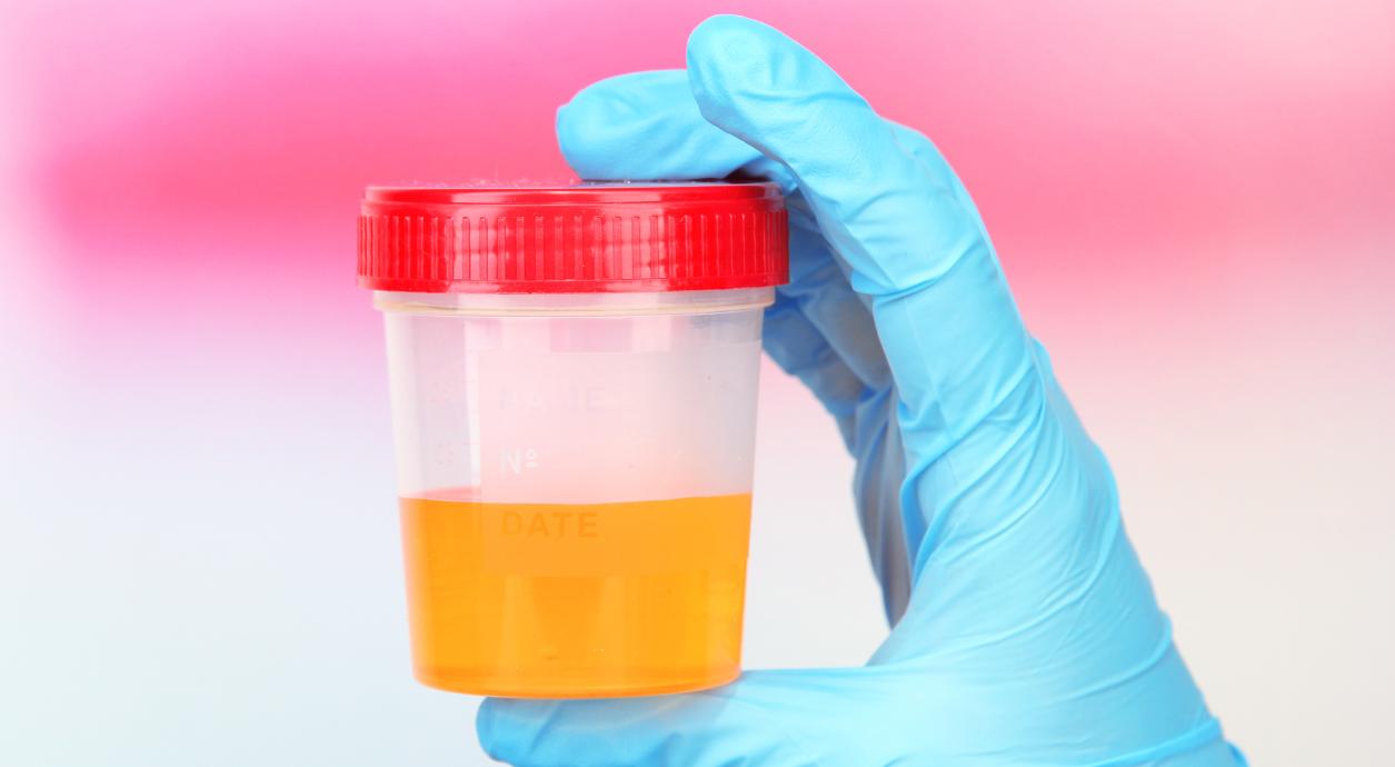 О чем свидетельствует кровь в моче