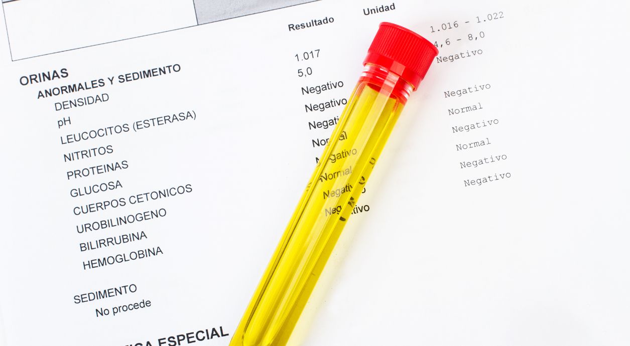 От чего может быть белок в моче
