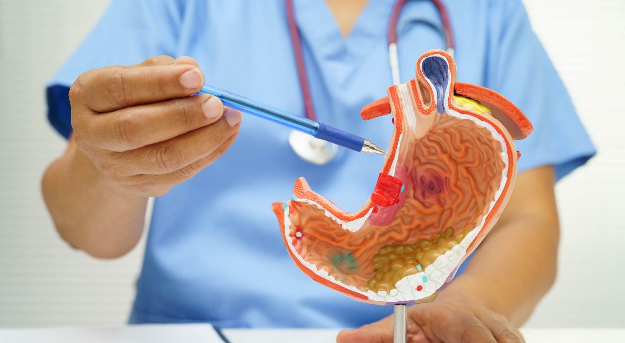 Forms of chronic gastritis according to the nature of the lesion