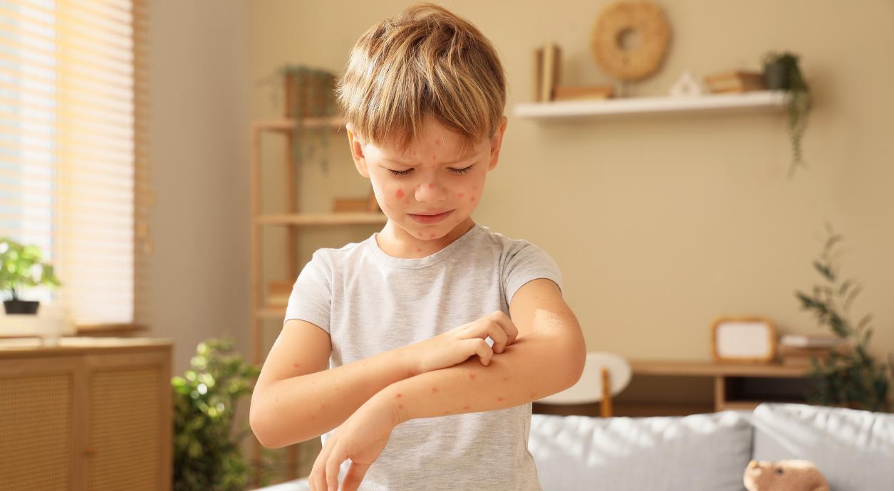 Що таке Коксакі: як передається вірус та як лікувати