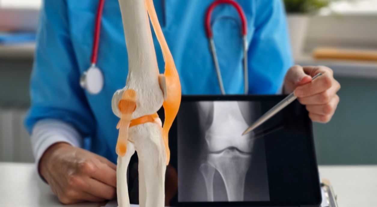 What Is “Runner’s Knee”: How to Get Rid of Pain