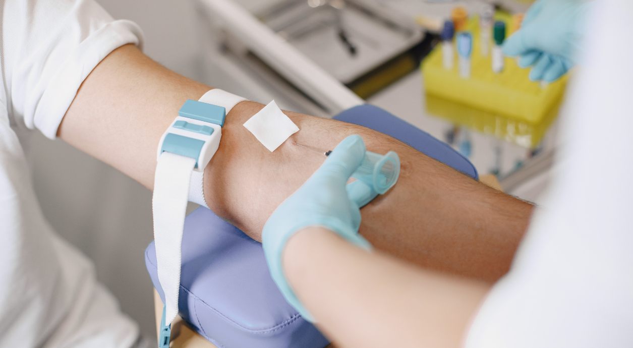 Рівень кортизолу — референтні значення