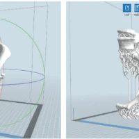 3D-моделирование и предоперационная подготовка: инновации в отделении ортопедии «Оксфорд Медикал»