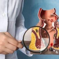 Безопераційне лікування геморою в «Оксфорд Медікал» у Києві