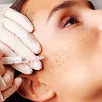 Биоревитализация кожи вокруг глаз