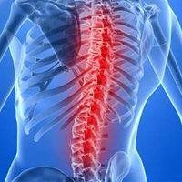 Чем опасен грудной остеохондроз позвоночника?