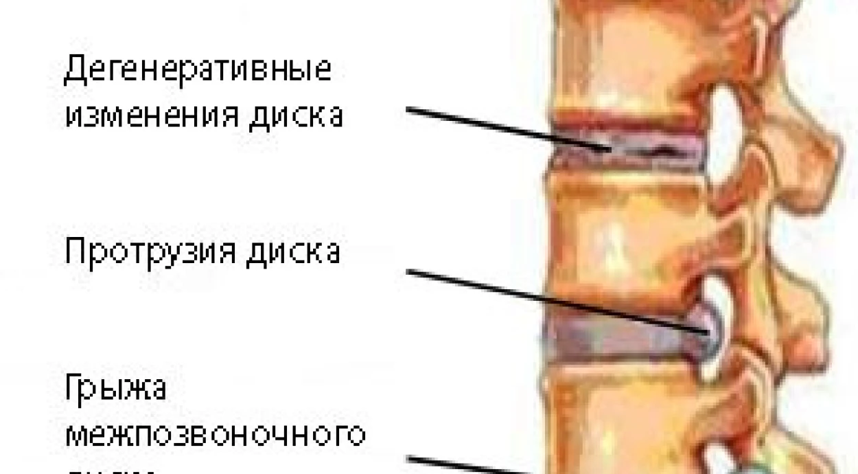 Чим небезпечні болі в шиї?