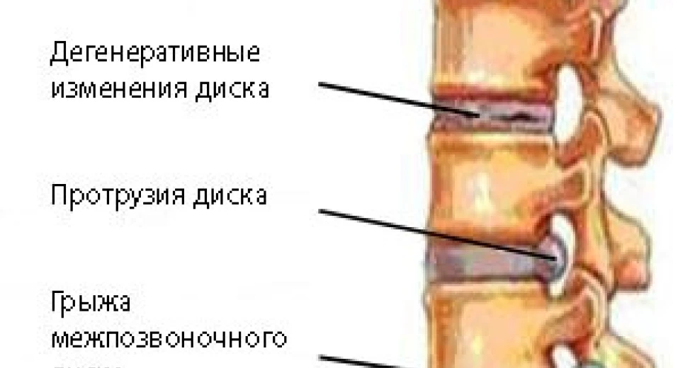 Чим небезпечні болі в шиї?