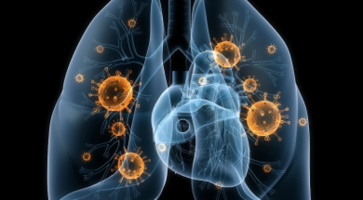 Что делать при воспалении легких