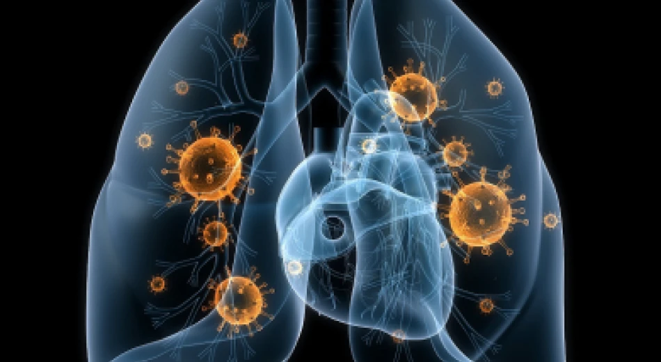 Що робити при запаленні легенів