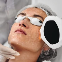 Что такое IPL-терапия: эффективный метод омоложения кожи