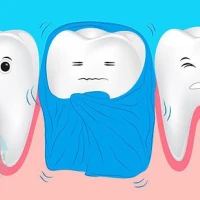 Чувствительность зубов