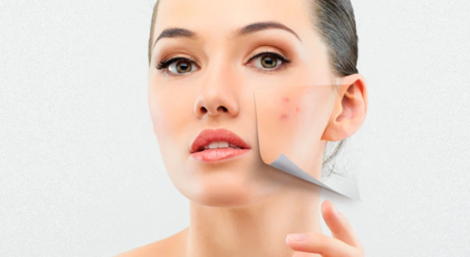 Демодекоз: симптоми, причини та методи лікування