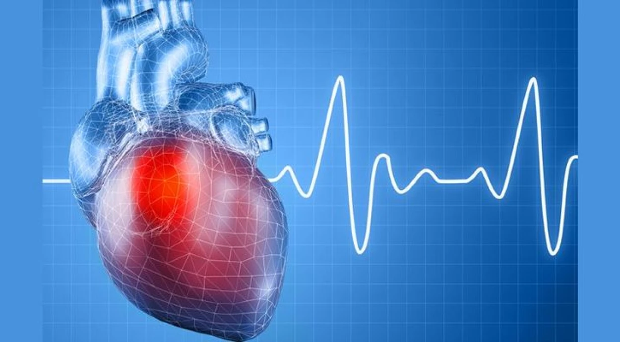 Экстрасистолия: как проявляется и как лечат?