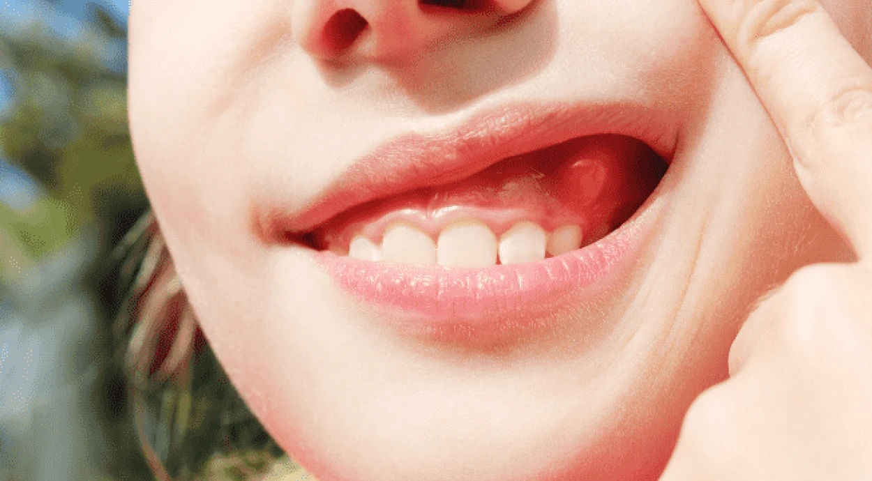 Флюс на десне: причины, симптомы и методы лечения