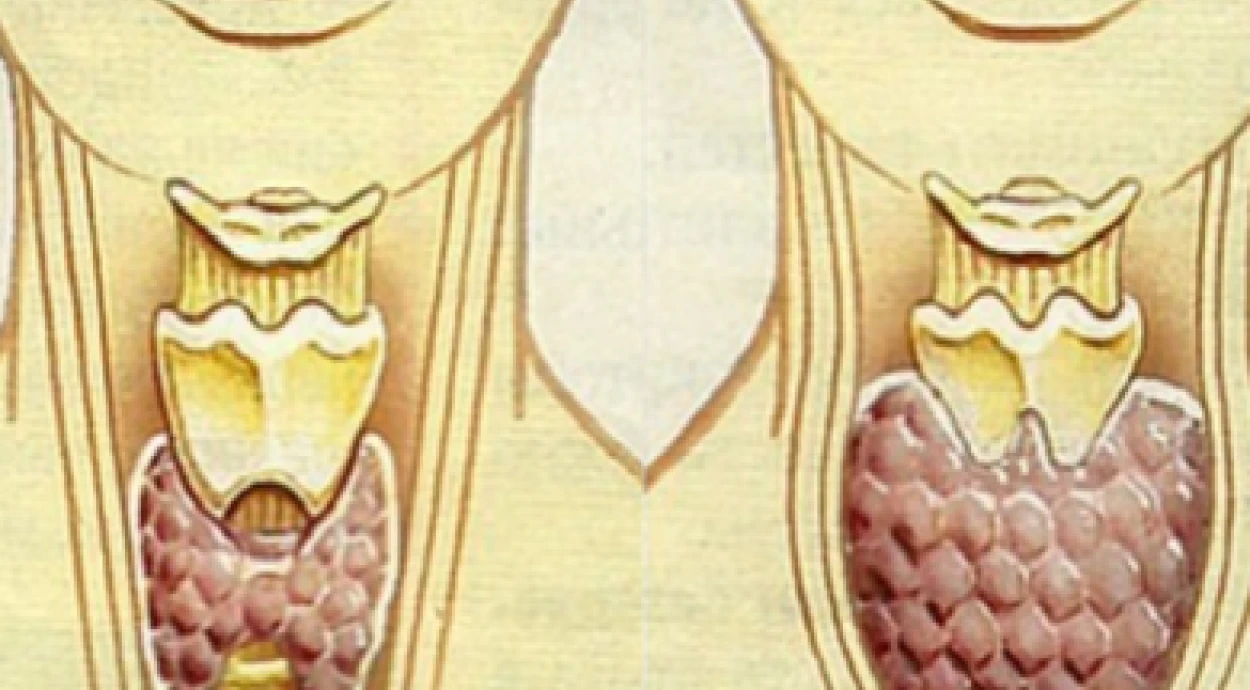 Гипотиреоз: основные причины появления и симптомы