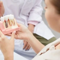 Имплант Megagen под ключ