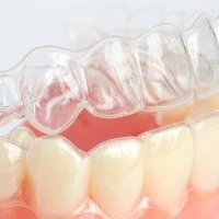 Инвизилайн в ортодонтии