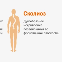 Искривление позвоночника: диагностика и лечение