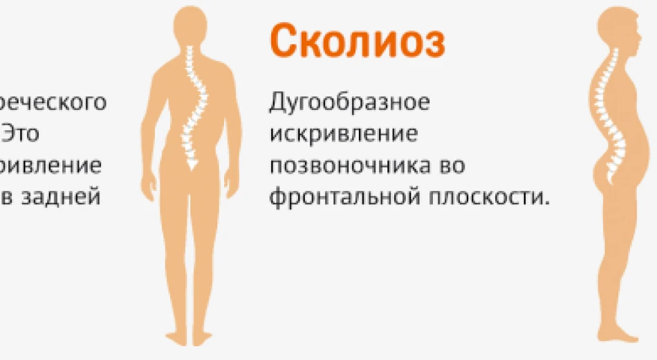 Искривление позвоночника: диагностика и лечение