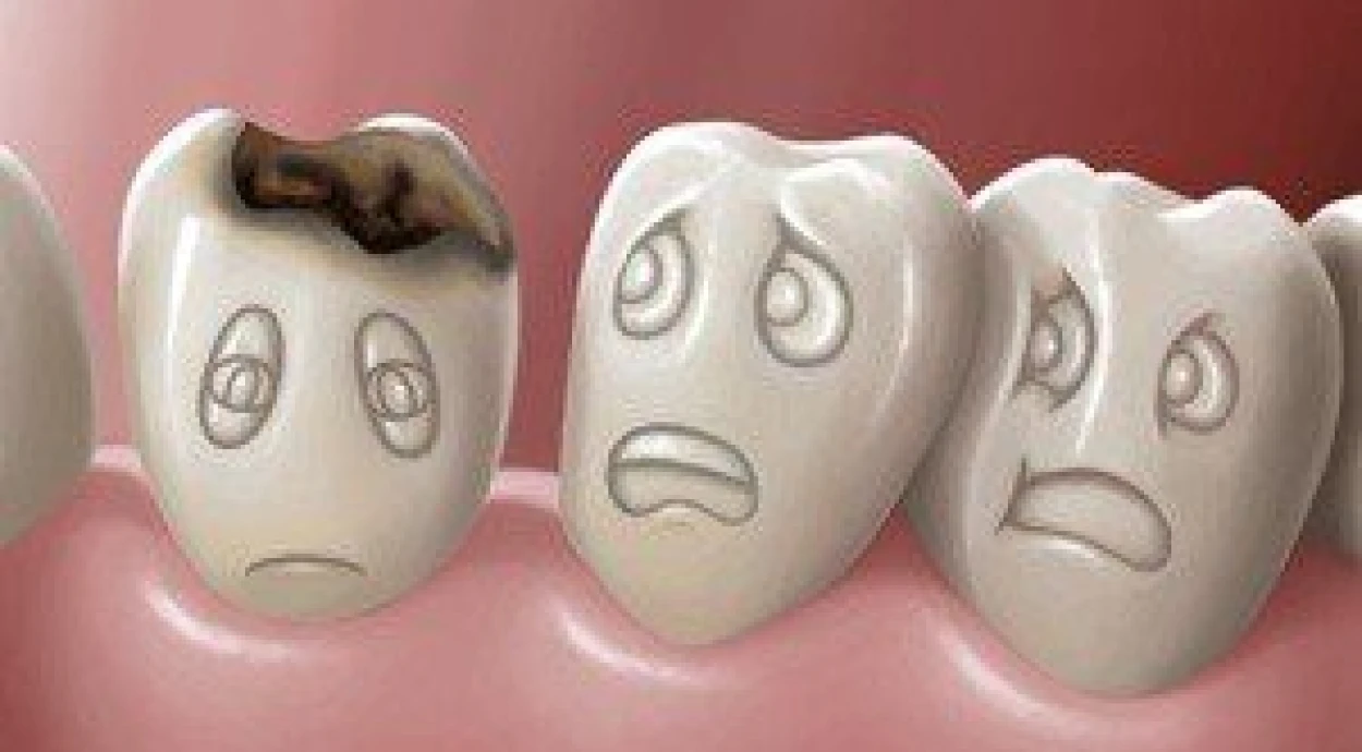 Як і навіщо боротися з карієсом?