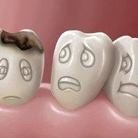 Как и зачем бороться с кариесом?