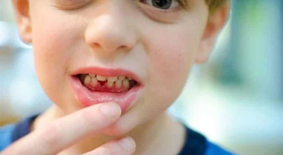 Как лечить гингивит у детей?