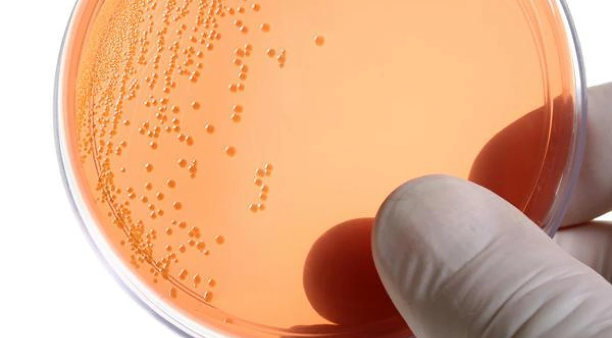 Как проявляется хламидиоз и как его лечат?