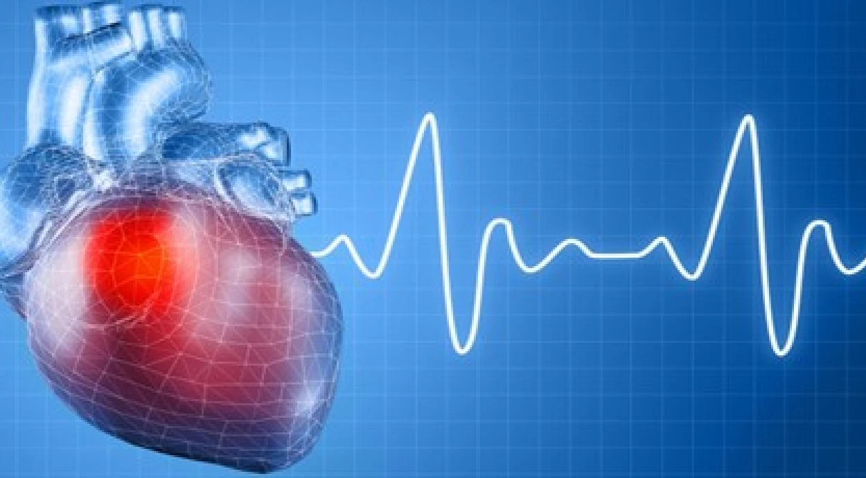 Как расшифровать кардиограмму?